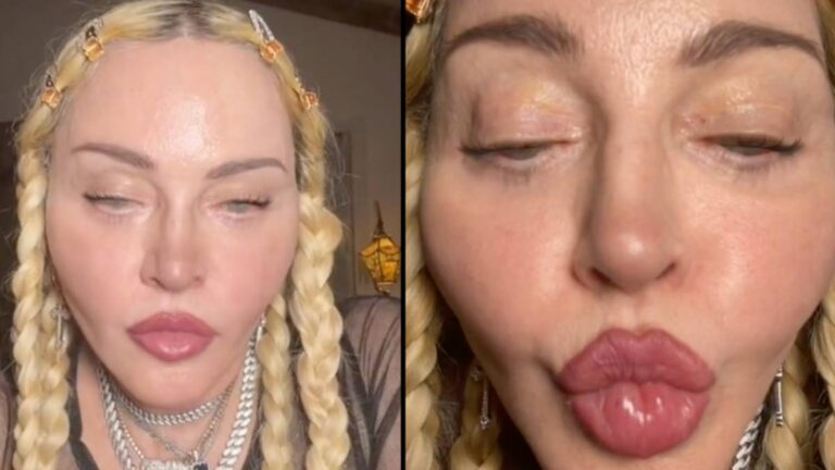 Madonna: Αναστατωμένοι οι θαυμαστές της