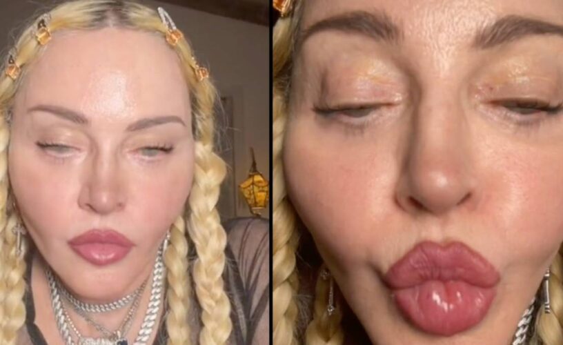 Madonna: Αναστατωμένοι οι θαυμαστές της. 