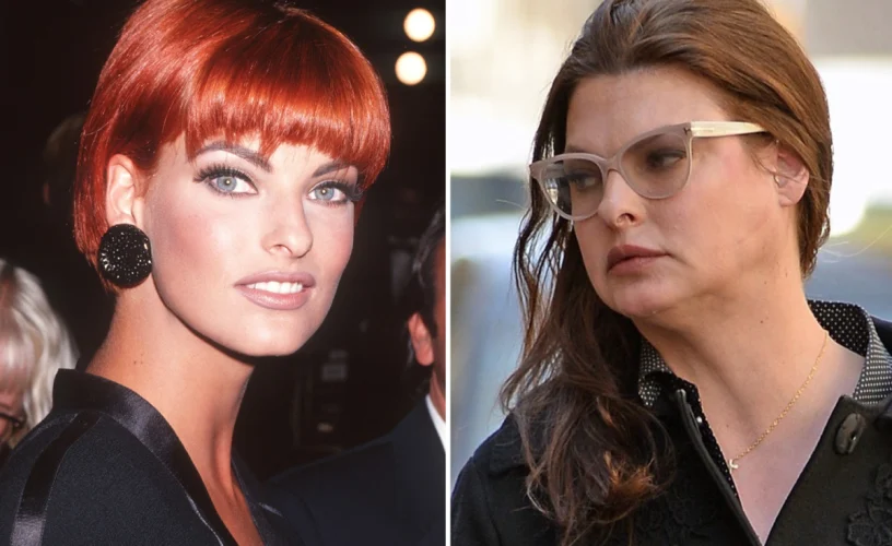 Linda Evangelista: Έδειξε το πρόσωπο της μετά από χρόνια-Παραμορφωμένη και αγνώριστη!